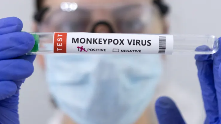 How to protect yourself against monkeypox and what to do if you catch it